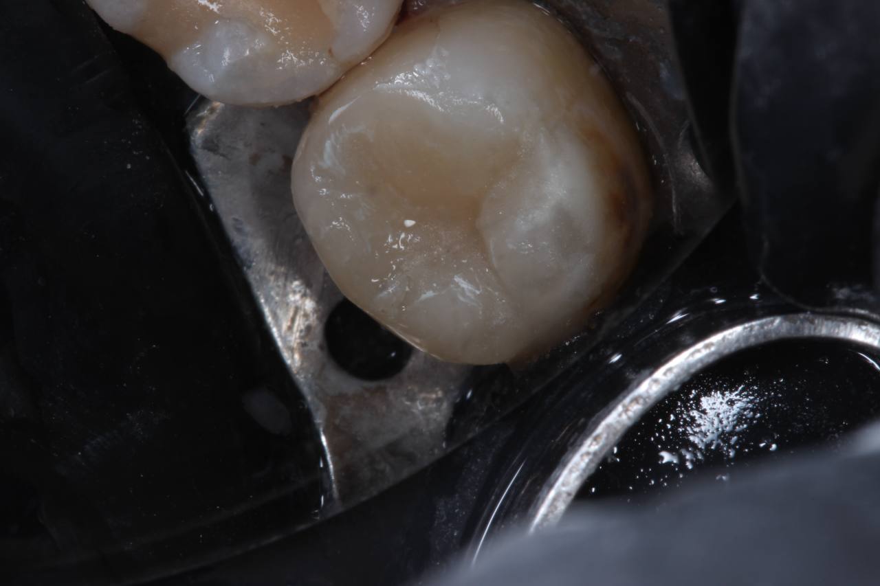 After image